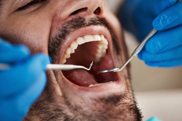 Full Mouth Reconstruction in Old Orchard, PA